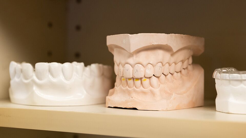 Sins Of veneers transformation